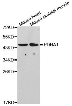 Western blot - PDHA1 antibody (144-01895)