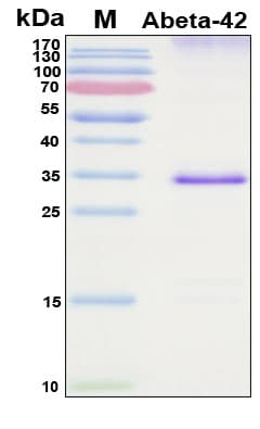 SDS-PAGE Image