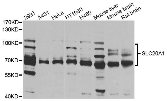 Western blot - SLC20A1 antibody (144-04117)