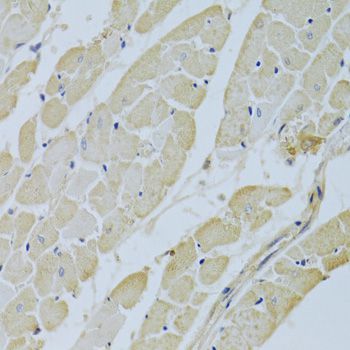 Immunohistochemistry - CA3 Antibody (144-01212)