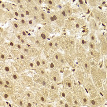Immunohistochemistry - ANP32A Antibody (144-05768)