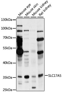 Western blot