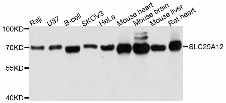 Western blot - SLC25A12 antibody (144-011688)