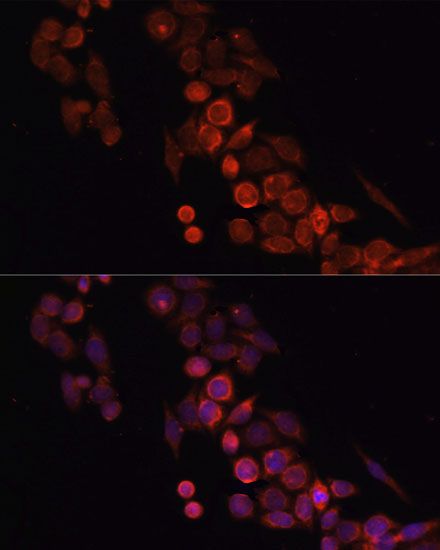 Immunofluorescence - CD4 Polyclonal Antibody (144-60019)