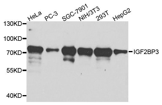 Western blot - IGF2BP3 Polyclonal Antibody (144-02750)