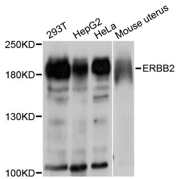 Western blot - [KO Validated] ErbB2 Polyclonal Antibody (144-02071)