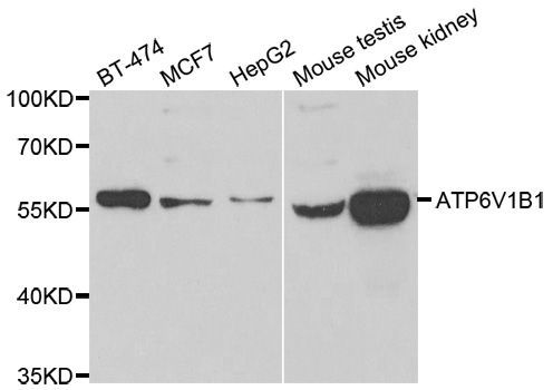 Western blot - ATP6V1B1 antibody (144-06876)