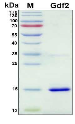 SDS-PAGE