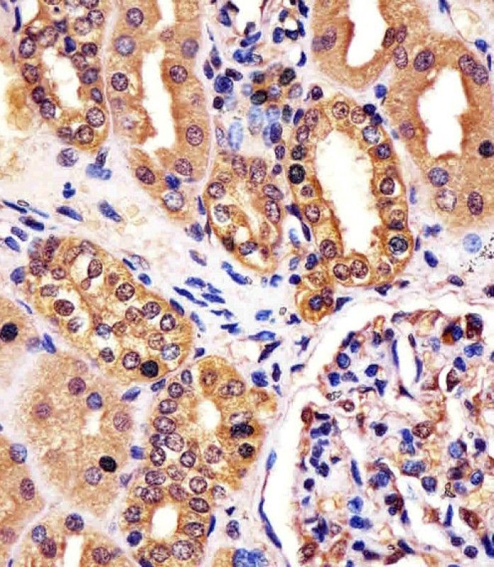 IHC-P