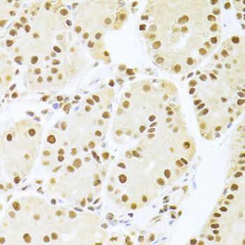 Immunohistochemistry - ANP32A Antibody (144-05768)