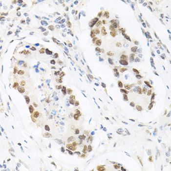 Immunohistochemistry - KPNA4 Antibody (144-02026)