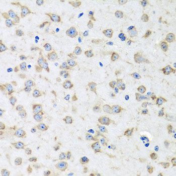 Immunohistochemistry - RPLP1 Polyclonal Antibody (144-06725)