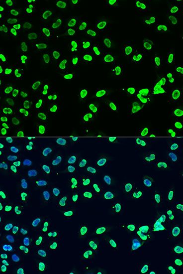 Western blot