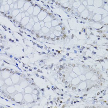 Immunohistochemistry - SNRNP70 antibody (144-06065)