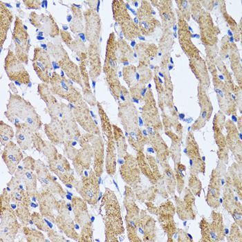 Immunohistochemistry - ATP5B Polyclonal Antibody (144-05769)