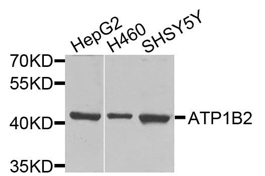 Western blot - ATP1B2 antibody (144-09928)