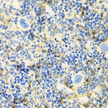 Immunohistochemistry - ICOS antibody (144-01811)