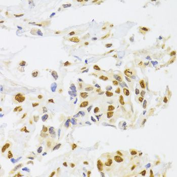 Immunohistochemistry - HNRNPA1 Polyclonal Antibody (144-07491)