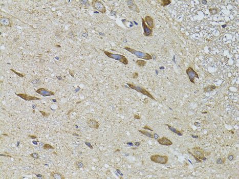 Immunohistochemistry - ADRBK2 Antibody (144-02049)