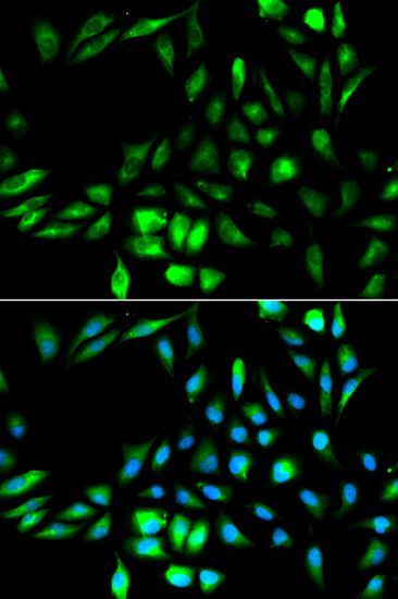 Immunofluorescence - KPNA2 Polyclonal Antibody (144-01623)