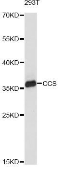Western blot - CCS antibody (144-61441)