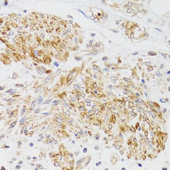 Immunohistochemistry - MYO5A antibody (144-09830)