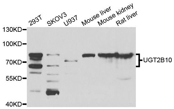 Western blot - UGT2B10 antibody (144-07570)