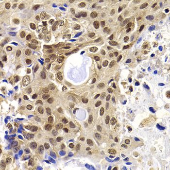 Immunohistochemistry - PHF19 Polyclonal Antibody (144-08065)
