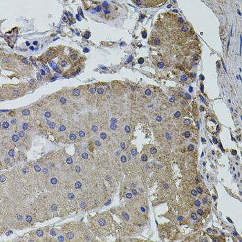 Immunohistochemistry - UBE2S antibody (144-04658)
