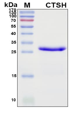 SDS-PAGE Image
