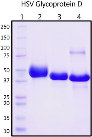 SDS-PAGE