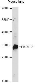 Western blot - PKD1L2 antibody (144-014954)