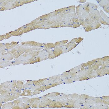 Immunohistochemistry - TRAP1 Antibody (144-02748)