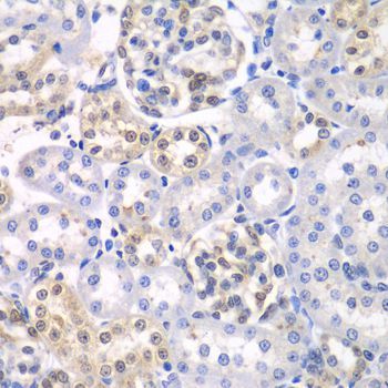 Immunohistochemistry - HDAC2 Polyclonal Antibody (144-02084)