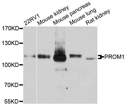 Western blot - PROM1 Polyclonal Antibody (144-12711)