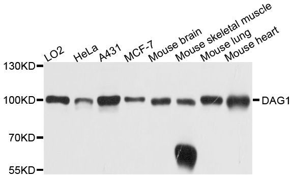 Western blot - DAG1 Polyclonal Antibody (144-10076)