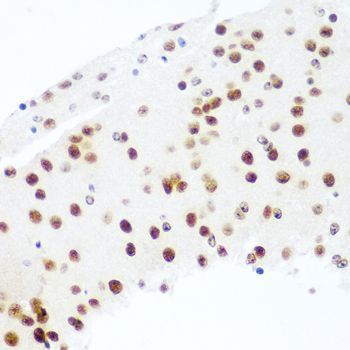 Immunohistochemistry - AGO2 antibody (144-06023)
