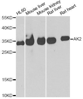 Western blot - [KO Validated] AK2 Polyclonal Antibody (144-06519)