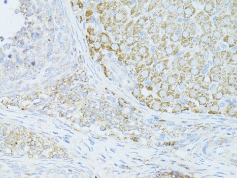 Immunohistochemistry - OCLN antibody (144-02601)