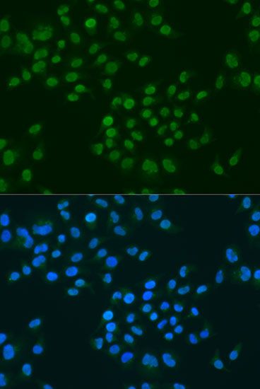 Immunofluorescence - CIRBP antibody (144-06080)