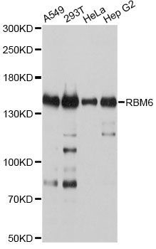 Western blot - RBM6 Polyclonal Antibody (144-10391)