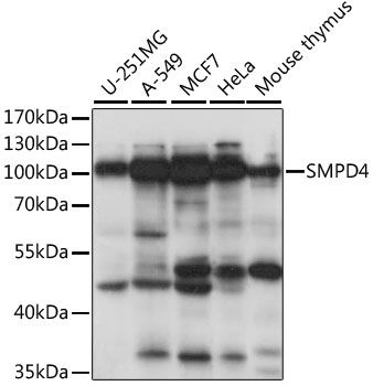 Western blot - SMPD4 antibody (144-61071)