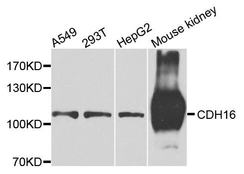 Western blot - CDH16 antibody (144-07882)