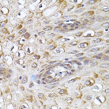 Immunohistochemistry - CETP antibody (144-01355)