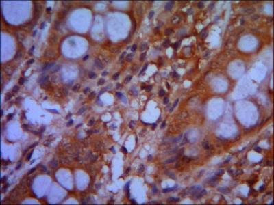 IHC