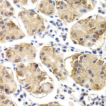 Immunohistochemistry - CHIT1 antibody (144-02015)