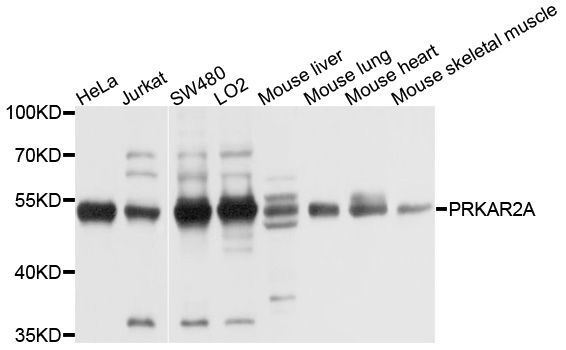 Western blot - [KO Validated] PRKAR2A Polyclonal Antibody (144-01531)