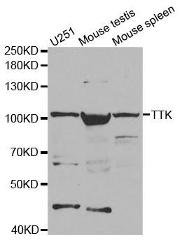 Western blot - TTK Polyclonal Antibody (144-02500)