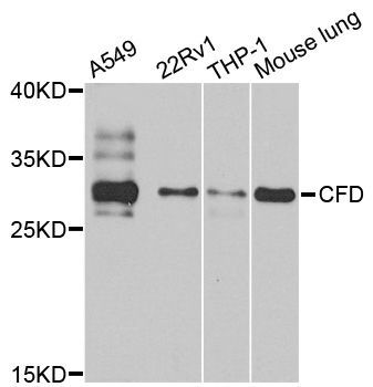 Western blot - CFD antibody (144-08117)
