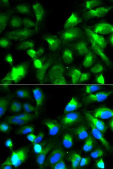 Immunofluorescence - SNAP25 Polyclonal Antibody (144-00986)